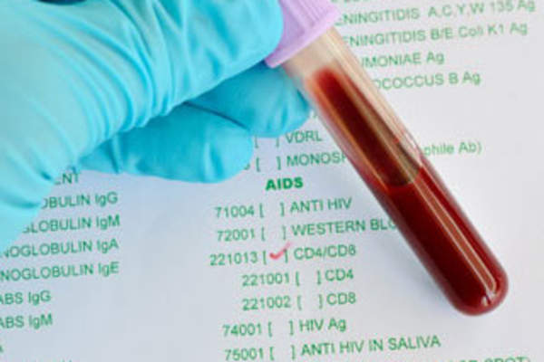 Is Measuring CD4 Enough?