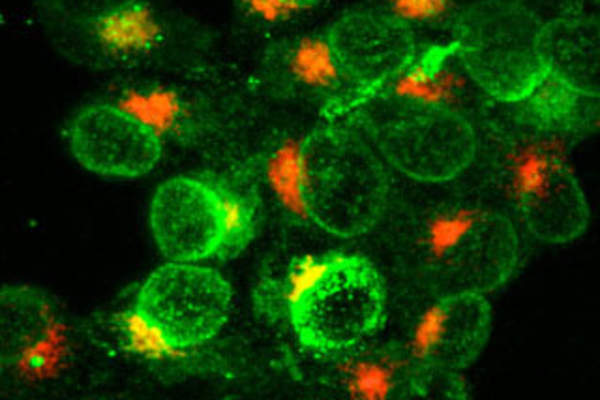 What Is an Infection?