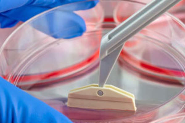 Stem Cell Transplantations