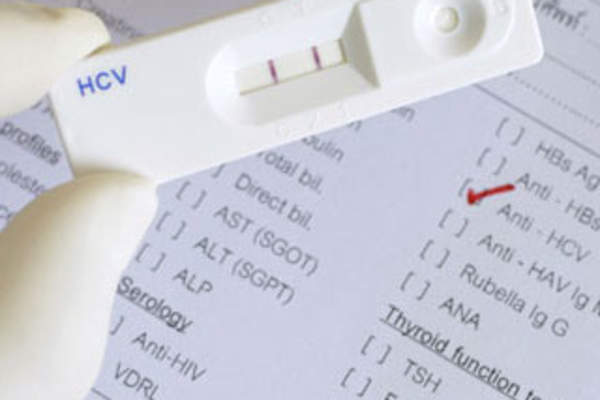 Who Should Get Tested for HCV?