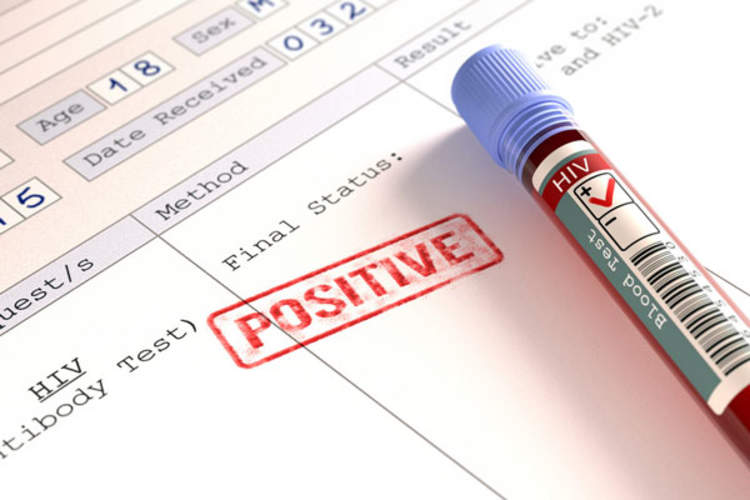 Even as federal agencies and public health organizations have taken steps to address HIV in vulnerable populations, sex workers have been left out of the conversation. (Credit: Shutterstock)