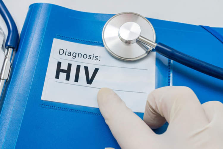 HIV diagnosis
