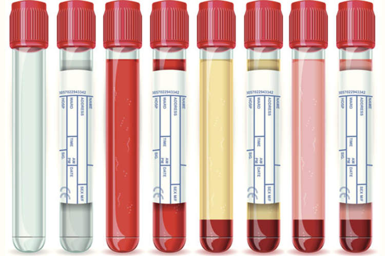 blood vials