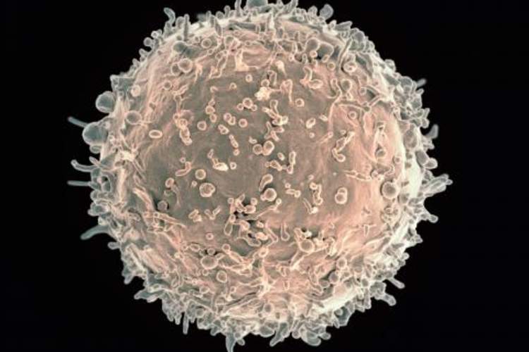 Colorized scanning electron micrograph of a B cell from a human donor
