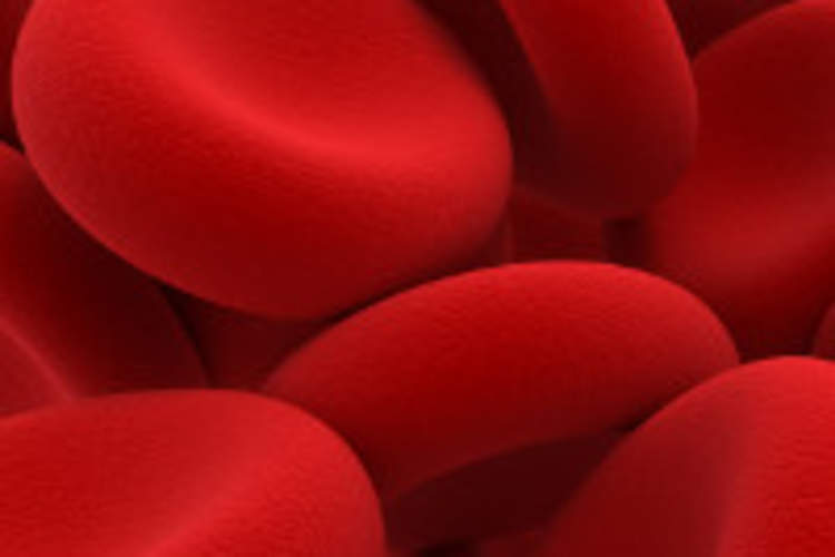 Women, Anemia and HIV/AIDS Img