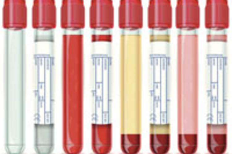 Understanding HIV-Related Lab Tests II: Viral Load, Resistance and Tropism Img