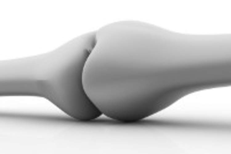 Bone Health and HIV/AIDS Img