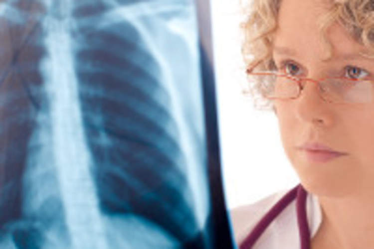 Tuberculosis and HIV/AIDS Img
