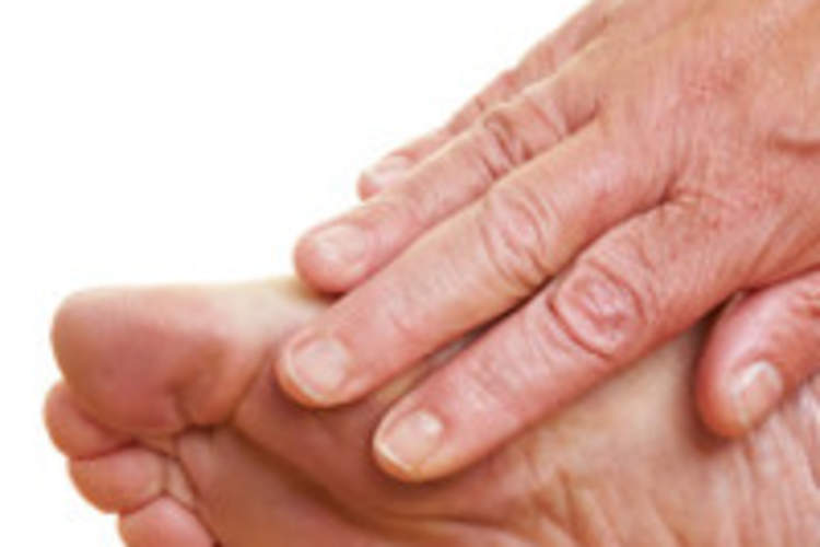 Peripheral Neuropathy and HIV/AIDS Img