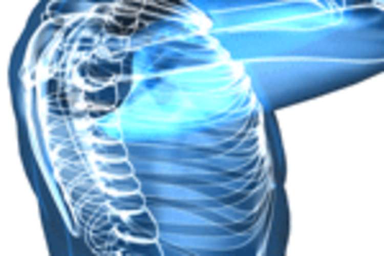 Bone Disease and Older HIV-Positive Women Img