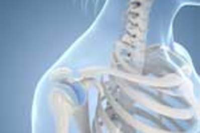 Preventing and Treating HIV-Associated Bone Disease Img