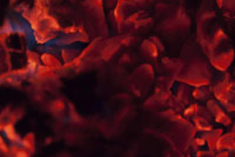 Even With Early HIV Meds, Signs of Gut-Damaging Inflammation Are High Img