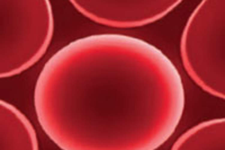 HIV Experts Discuss Inflammation and HIV Img