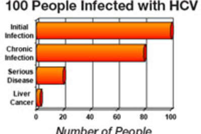 If 100 People Were Infected With Hepatitis C (Infographic) Img