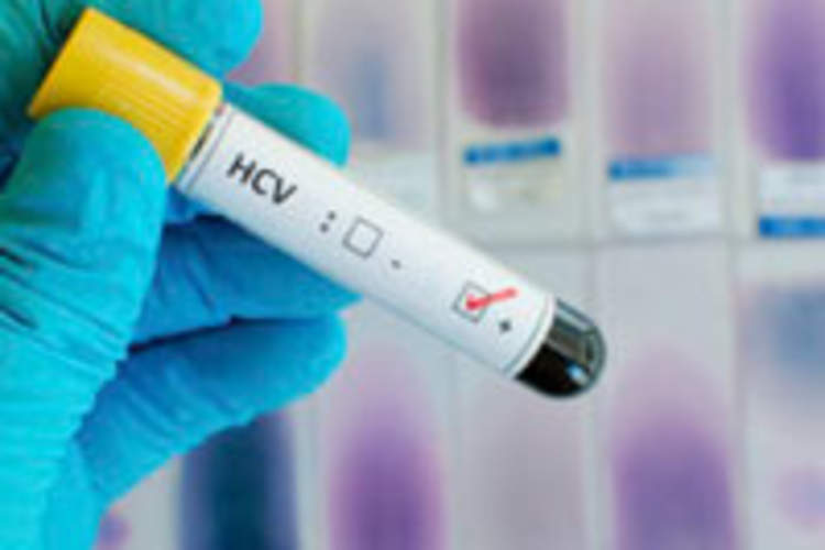 Medicaid Denies Nearly Half of Requests for Hepatitis C Drugs: Study Img
