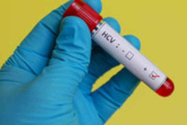 Hepatitis C: Behind New Wonder Drugs Lies a Terrible Dilemma Img