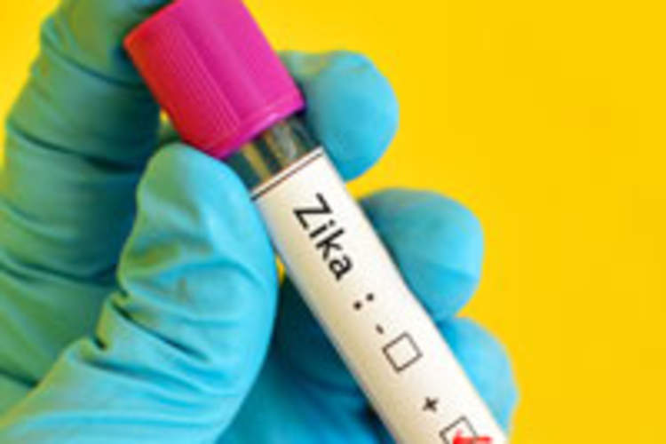 Zika Virus and HIV/AIDS: Similarities and Differences Img