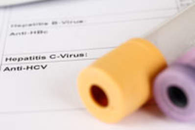 Are Hepatitis C RNA Tests Too Variable for Planning 8-Week Treatment Regimens? Img