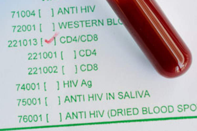 Treatment in Primary HIV Infection Is Significantly More Likely to Normalize CD4:CD8 Ratio Img