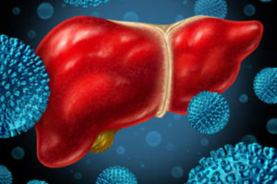No Increased Risk of Liver Cancer After Hepatitis C Treatment With Direct-Acting Antivirals Img