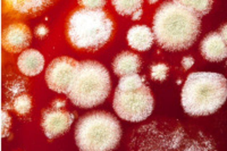 Fungal Infections Still Kill Too Many People With HIV Img