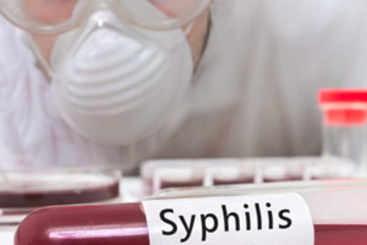 HIV Treatment May Be Behind Rising Syphilis Rates Among Gay Men Img
