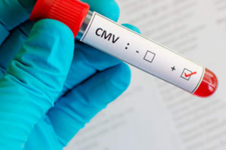 Soluble CD163 as a Marker of CMV-Mediated Immune Activation Img