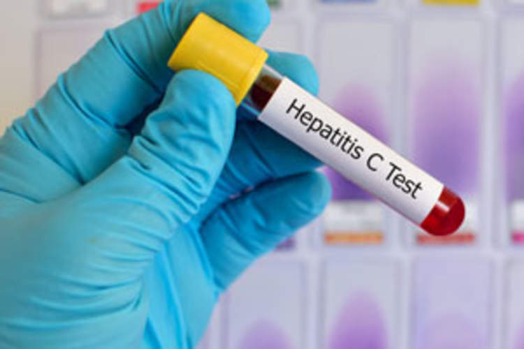 Canadian Women's Experiences Receiving a Hepatitis C Diagnosis Img