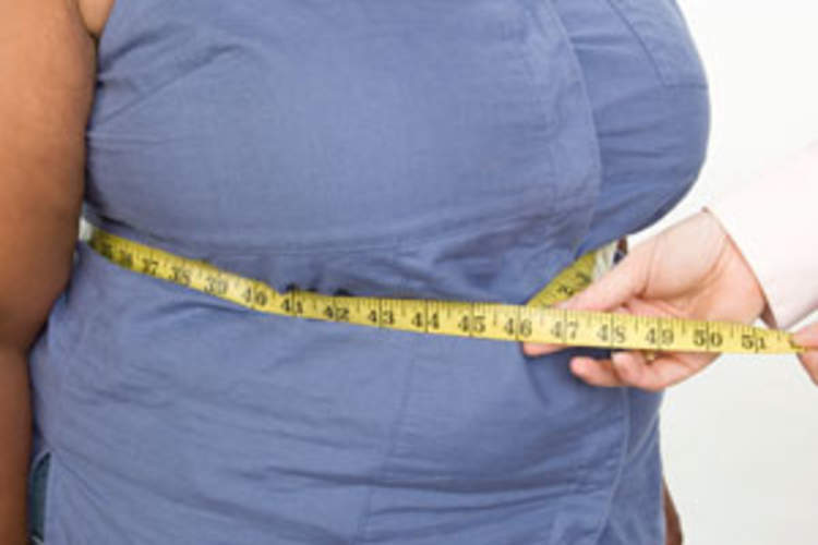 Higher Baseline Viral Load and Black Race Predict Severe Weight Gain on HIV Treatment Img