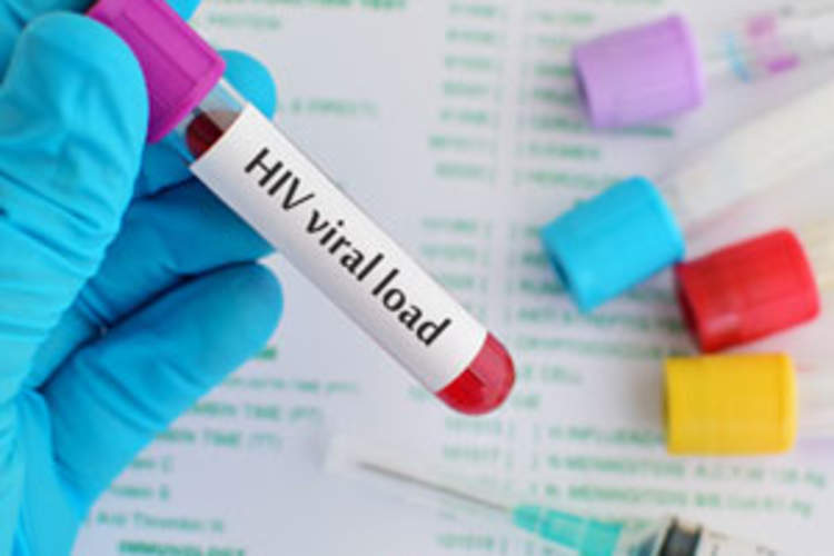 'Stop Describing, Start Intervening': Can the CDC's New Viral Load Data Help Guide HIV Programs? Img