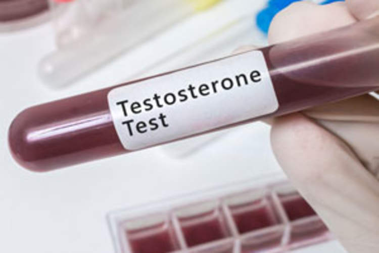 Do Integrase Inhibitors Affect Testosterone Levels in Men? Img