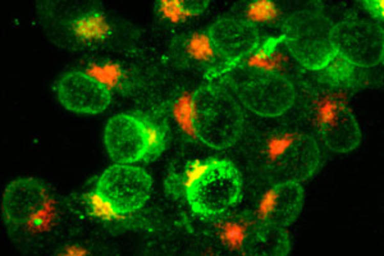 Increased Risk of IRIS With Integrase Inhibitors Reported in Two Studies Img