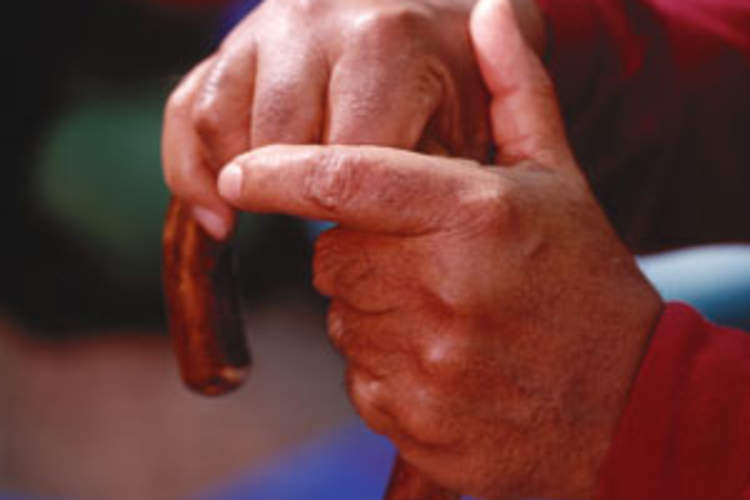 HIV Patients 65 Years or Older Face Higher Rates of Serious Non-HIV Illnesses Img
