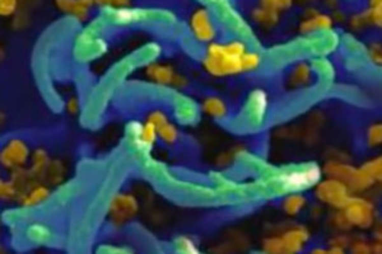 Real or Not? HIV Cure in Animals Using CRISPR Gene Editing Img