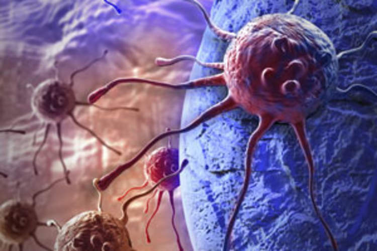 New Cancer Rates Climbing With Age in HIV Patients, but Age Impact Differs by Cancer Type Img