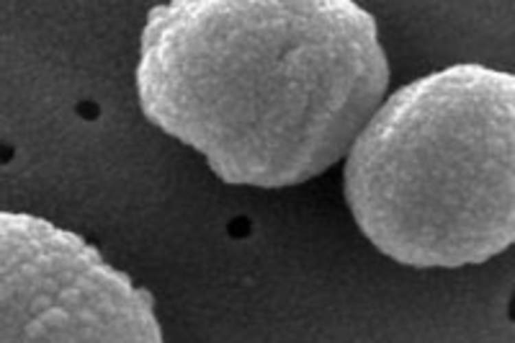 Pneumococcal Disease 13 Times More Frequent in People With HIV Img