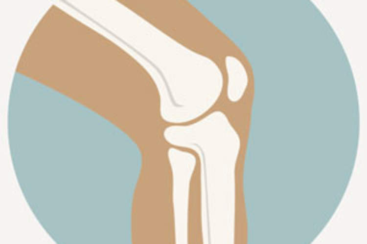 Case Report of Capsulitis With Elvitegravir and Cobicistat (EVG/c) Img