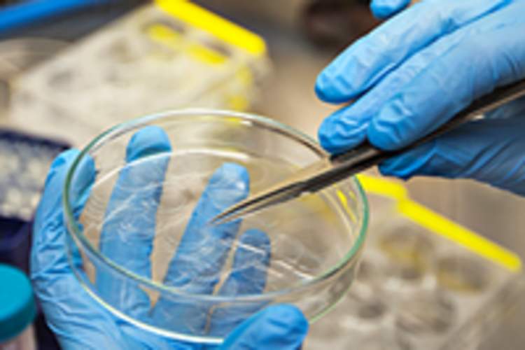 This Week in HIV Research: New Discovery in How HIV Hijacks a Cell Img