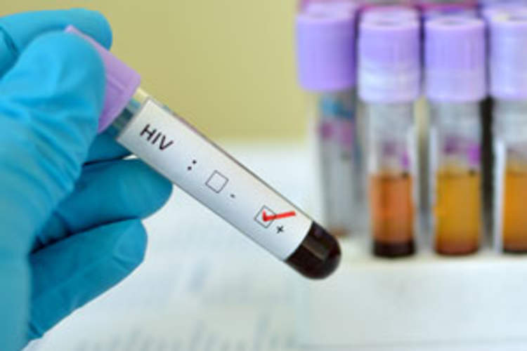 New HIV Rate Similar Above and Below Age 45 in 86,836-Person U.S. Study Img
