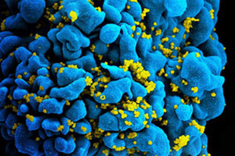NIH and Partners Launch HIV Vaccine Efficacy Study Img