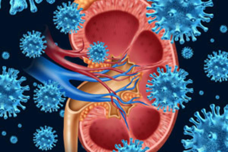 HIV and Kidney Disease Img