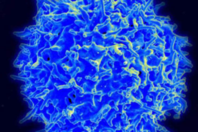 Study Links Gut-Homing Protein Levels With HIV Infection Risk, Disease Progression Img
