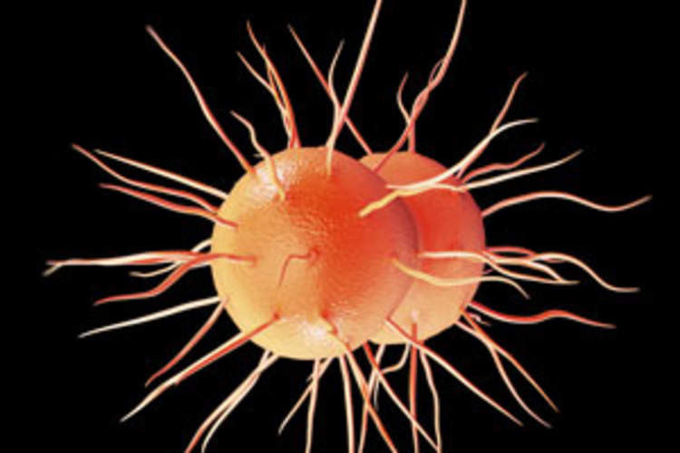 If Your Patient Has Gonorrhea, Make Sure You Treat Them With Ceftriaxone Plus Azithromycin Img