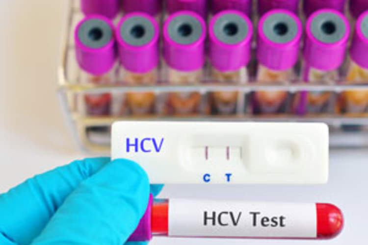 HCV Cure and the Long Road to Recovery Img