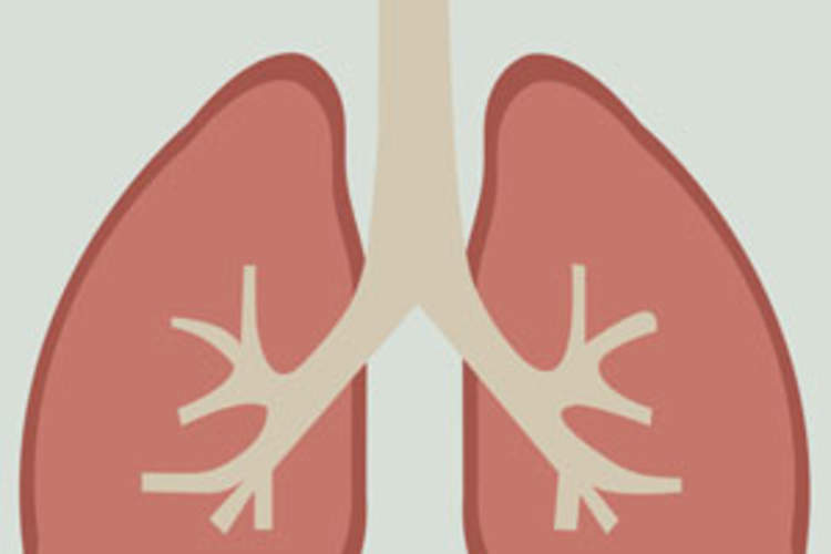 Big 3 Lung Cancer Risk Factors With HIV: Smoking, Low CD4s, Lung Infection Img