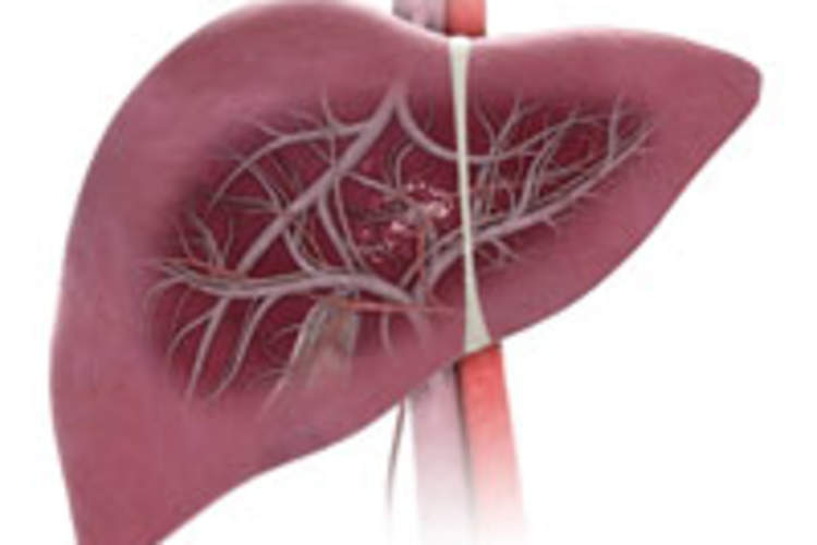 Hepatitis C versus the Immune System: The Biology of Hepatitis C Transmission Img