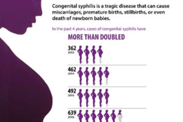 Newborn Syphilis Cases More Than Double in Four Years, Reaching 20-Year High Img