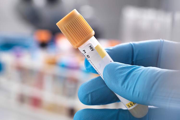CDC: Most HIV Transmissions Are From People Who Are Not in Care Img