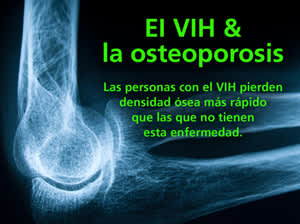 El VIH & la Osteoporosis