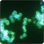 Antibiotic-Resistant Gonorrhea